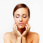 Skin Whitening Treatment Skin Whitening Treatment