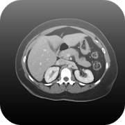 Radiology CT Viewer