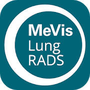 MeVis Lung-RADS MeVis Lung-RADS