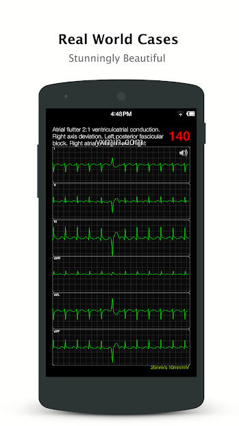 【图】ECG Pro – Real World ECG / EKG(截图2)