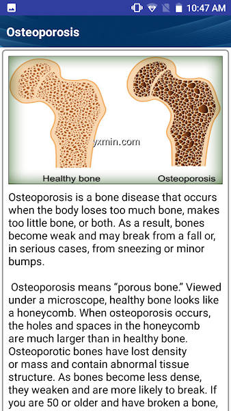 【图】Osteoporosis Low Bone Density Weak Bones Diet Help(截图2)