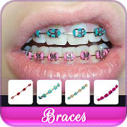 Braces Colors Beauty Braces Colors Beauty