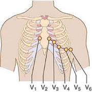Clinical ECG Guide. Clinical ECG Guide.