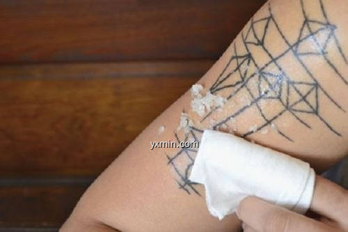 【图】Tattoo Removal(截图2)